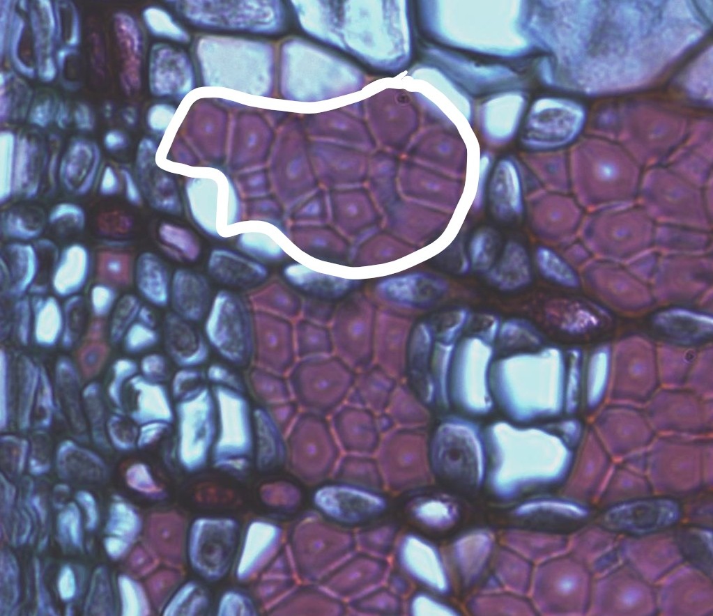 Una sección transversal de portaobjetos con un grupo de células teñidas de rojo oscuro en un círculo