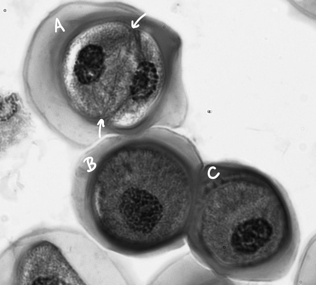 Tres celdas. La celda A tiene dos núcleos visibles divididos por una pared. Las células B y C tienen solo un núcleo visible.