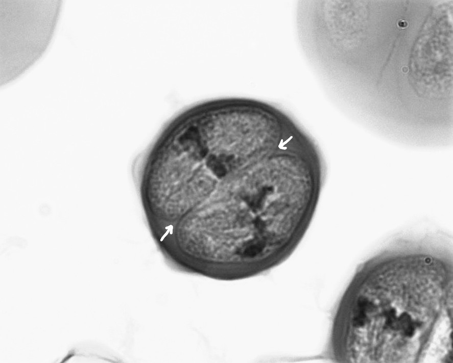 A single pollen mother cell with a cell wall running down the center