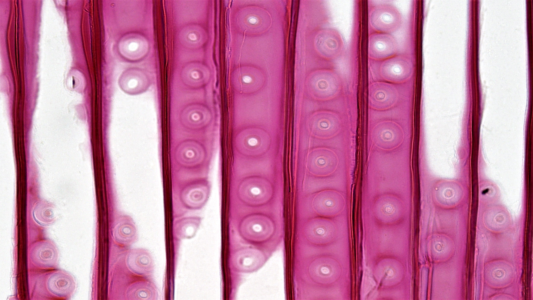 Tracheids appear as pink columns. Pit pairs look like stacks of bulls eyes along each tracheid.