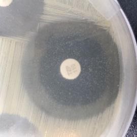 circular region without bacterial growth around a circular paper disk 