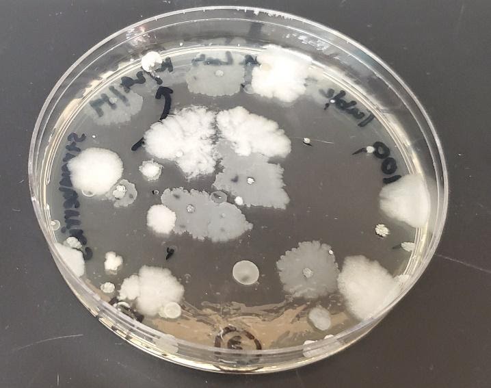 Nutrient agar media plate with various colony types growing on it
