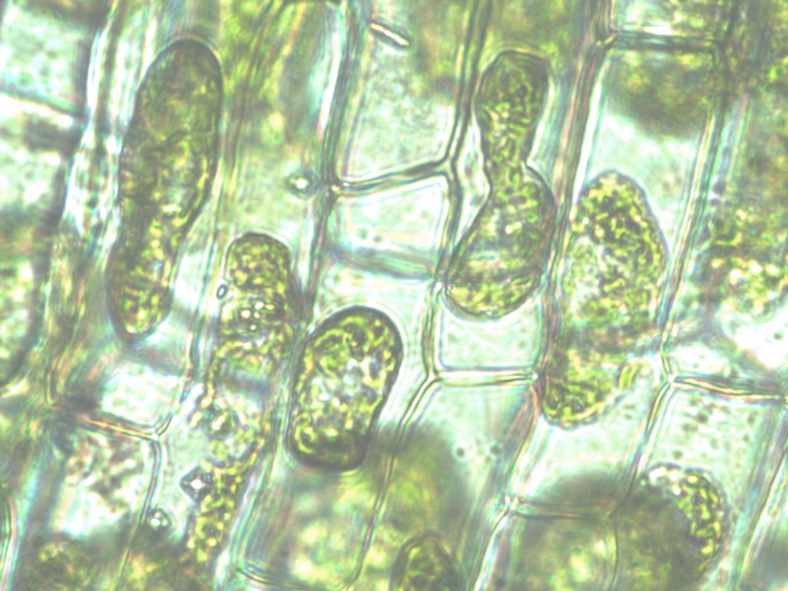 This is an image of Elodea cells treated with salt and viewed under 400x magnification.