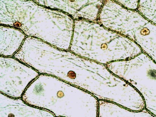 onion cells treated with iodine as viewed at 400x magnification.