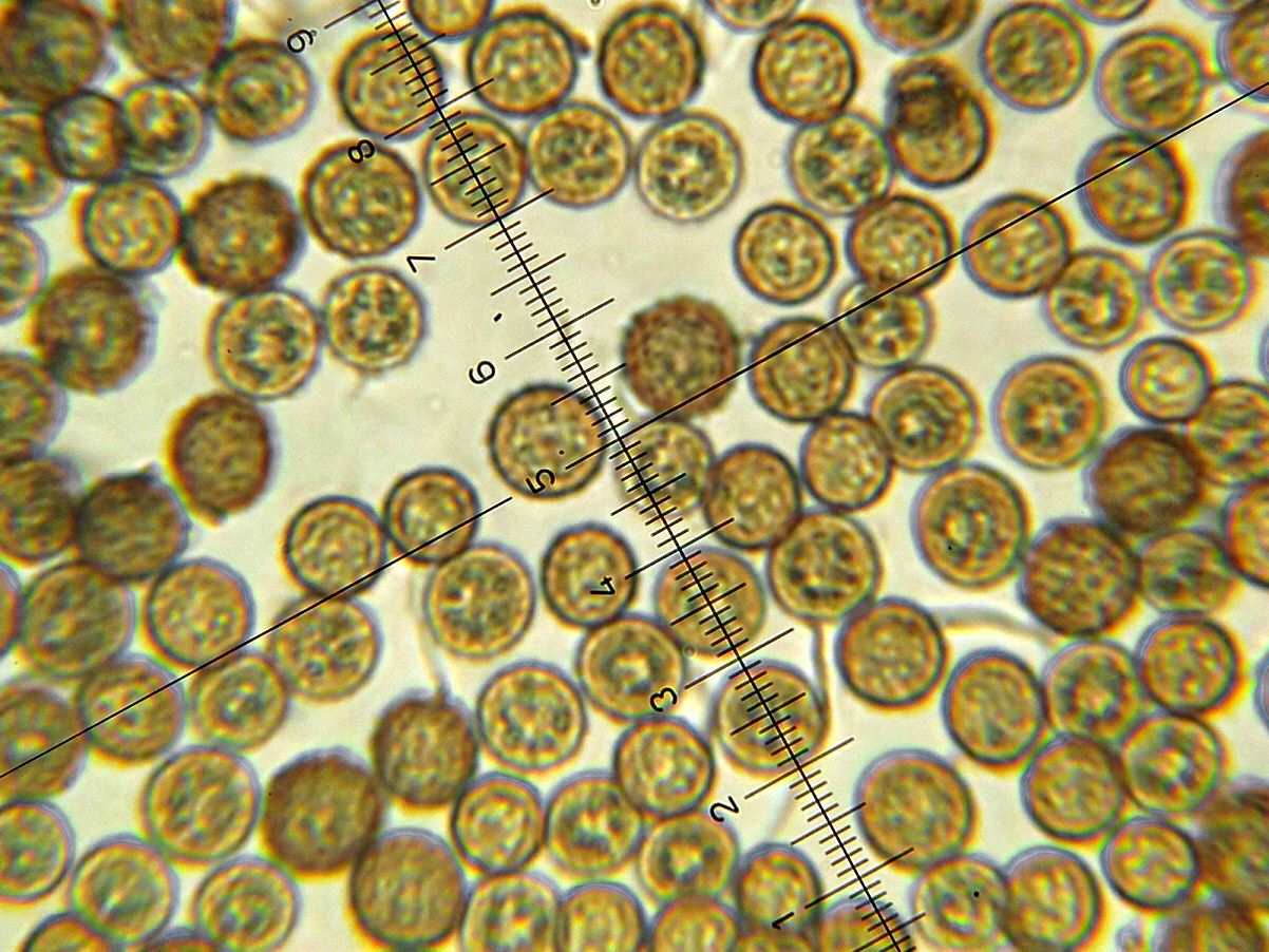 Esporas globosas y marrones vistas a través del microscopio