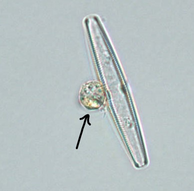 A clear, globose structure growing on the frustule of a diatom