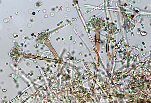 Microscopic view of conidiophores and conidia