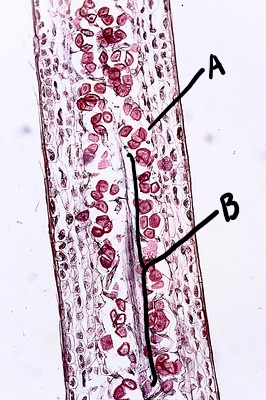 A cross section through a hornwort sporangium. The spores (labeled A) are clustered toward the inside around a central column (labeled B).