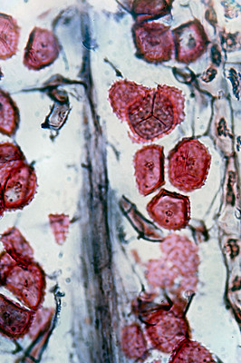 clusters of ornamented spores inside a hornwort sporangium. Together, the four spores make a sphere. 