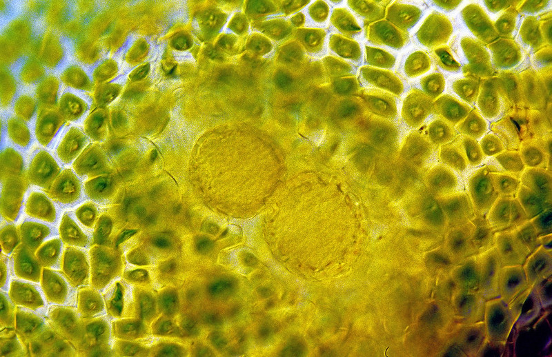 Close up of monoplastidic cells, each with one large plastid