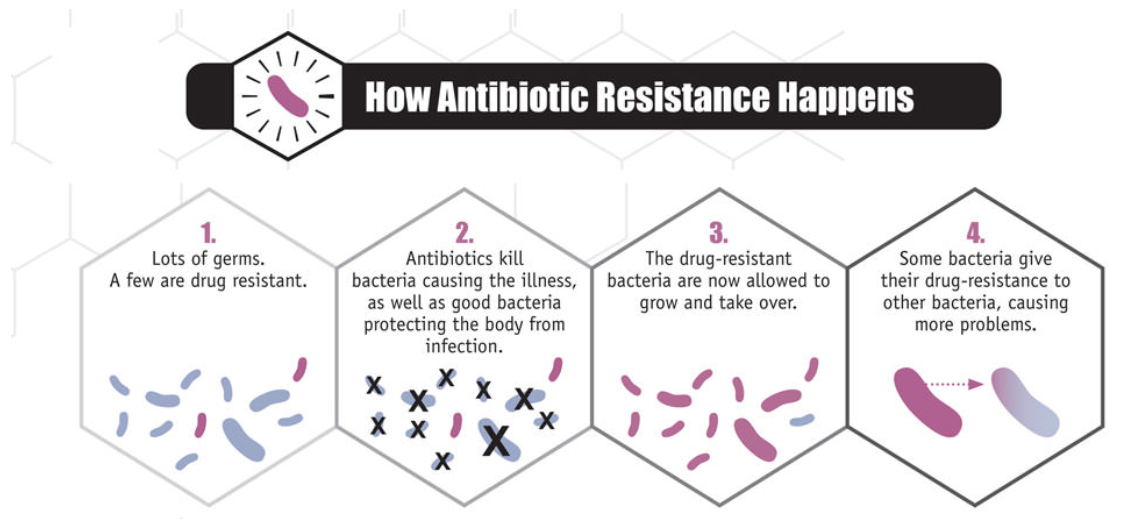 The process of antibiotic resistance in four steps. Susceptible microbes are represented in blue, and resistant ones are colored purple.