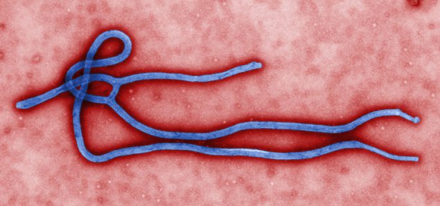 Microscopic Ebola virusi, ambayo inaonekana kama muda mrefu, vilima tube na matawi ya mara kwa mara.