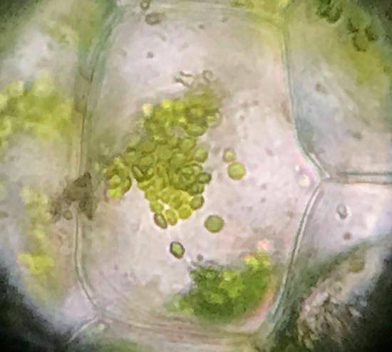 Elodea cell clearly showing chloroplasts