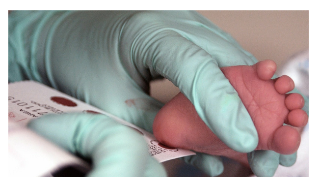 Blood from a newborn's foot is being placed on a card.