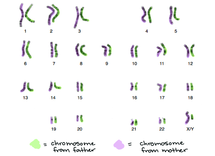Image of the karyotype of a human male, with chromosomes from the mother and father false-colored purple and green, respectively.