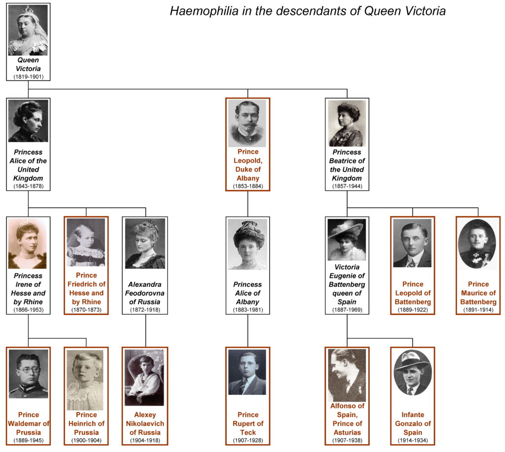 A family tree charting haemophilia in the descendants of Queen Victoria. Queen Victoria had three children: Princess Alice of the UK, Prince Leopold Duke of Albany, and Princess Beatrice of the UK. Of Queen Victoria's children, only Prince Leopold had haemophilia. Princess Alice had three children: Princess Irene, Prince Friedrich, and Alexandra Feodorovna. Of Princess Alice's children, only Prince Friedrich had haemophilia. Princess Irene had two sons, Prince Waldemar and Prince Heinrich, both of whom had haemophilia. Alexandra had one son, Alexy Nikolaevich, who had haemophilia. Queen Victoria's son Prince Leopold had one daughter, Princess Alice, who did not have haemophilia. Princess Alice had one son, Prince Rupert, who had haemophilia. Queen Victoria's daughter Princess Beatrice had three children: Victoria Eugenie, who did not have haemophilia, and two sons, prince Leopold of Battenberg and Prince Maurice of Battenberg, who both had haemophilia. Beatrice's daughter Victoria Eugenie had two sons, Alfonso of Spain and Infante Gonzalo of Spain, both of whom haemophilia.