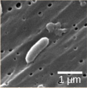 Micrograph shows rod-shaped Vibrio cholera, which are about 1 micron long.