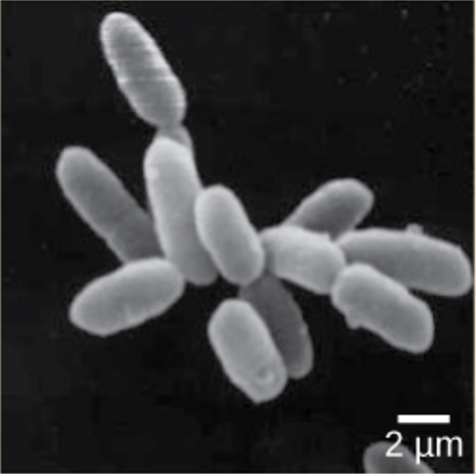 Micrograph shows rod-shaped Halobacterium.