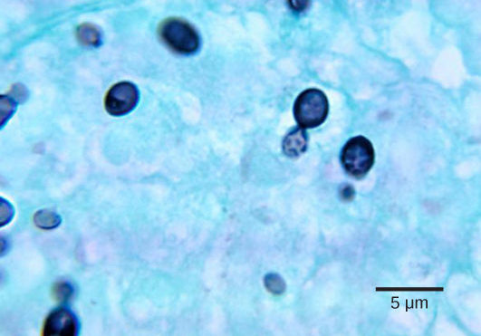 Micrograph shows budding yeast cells. The parent cells are stained dark blue and round, with smaller, teardrop shaped cells budding from them. The cells are about 2 microns across and 3 microns long.