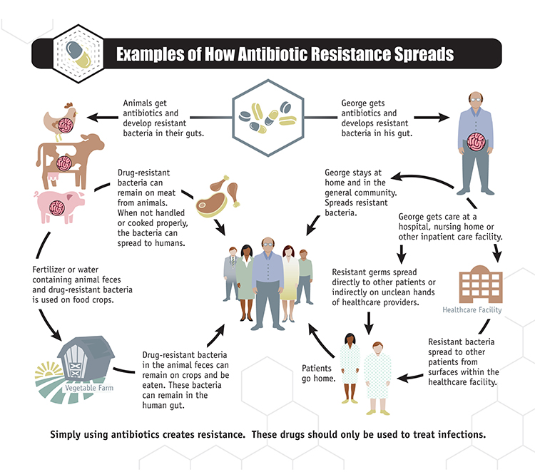 An infographic depicting how antibiotic resistance spreads. The graphic follows two distinct paths: Animals get antibiotics and develop drug-resistant bacteria in their guts or humans get antibiotics and develop drug-resistant bacteria in their guts. When animals develop drug-resistant bacteria the bacteria can spread in two ways: One drug-resistant bacteria can remain on meat from animals. When not handled or cooked properly, the bacteria can spread to humans. Two: fertilizer or water containing animal feces and drug-resistant bacteria is used on food crops. Drug-resistant bacteria in the animal feces can remain on crops and be eaten. These bacteria can remain in the human gut. There are two examples given of how resistance spreads when humans develop resistant bacteria. One: George gets care at a hospital, nursing home, or other inpatient care facility. Resistant germs can spread directly to other patients or indirectly on unclean hands of healthcare providers. Resistant bacteria can also spread to other patients from surfaces within the healthcare facility. The patients go home and the resistant bacteria spread further. Two: George stays at home and in the general community. He spreads the resistant bacteria that has developed in his gut.