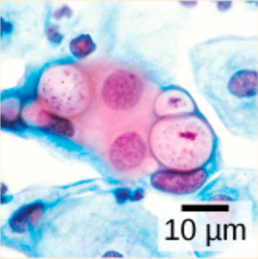 This ovoid shaped bacteria is seen among native cells