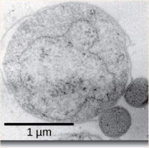 Micrograph shows two small, round N. equitans cells attached to a larger Ignococcus cell.