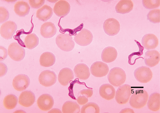 The micrograph shows round red blood cells, about 8 microns across. Swimming among the red blood cells are ribbon-like trypanosomes. The trypanosomes are about three times as long as the red blood cells are wide.