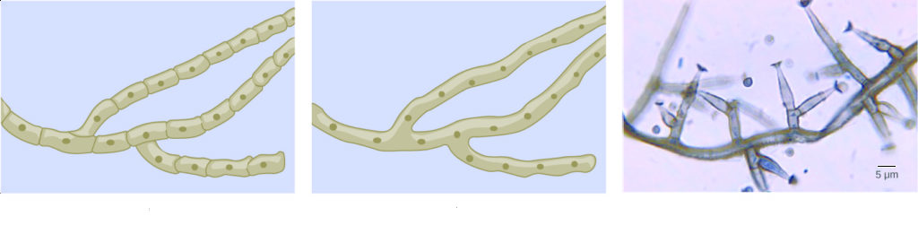 Part A is an illustration of septated hyphae. Cells within the septated hyphae are rectangular. Each cell has its own nucleus, and connects to other cells end-to-end in a long strand. Two branches occur in the hyphae. Part B is an illustration of coenocytic hyphae. Like the septated hyphae, the coenocytic hyphae consist of long, branched fibers. However, in coenocytic hyphae, there is no separation between the cells or nuclei. Part C is a light micrograph of septated hyphae from Phialophora richardsiae. The hyphae consists of a long chain of cells with multiple branches. Each branch is about 3 µm wide and varies from 3 to 20 µm in length.