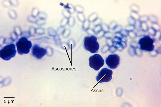 Micrograph shows asci, which appear as multiple, sphere-like shapes fused together into a structure about 7 microns across, and ascospores, which are small, light blue ovals about two microns wide by three microns long released from the asci.