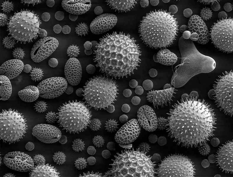 Microscopic particles of different shapes and sizes. Some are round while others are oblong.