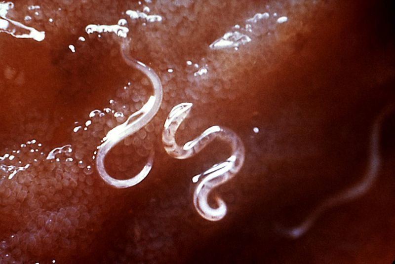 two hookworms. the worms are clear and anchored in the tissue of an intestine