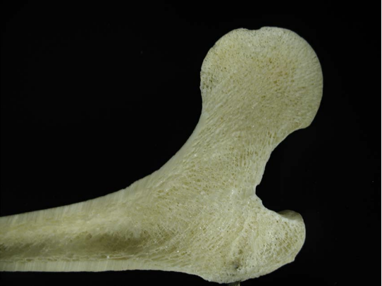 A photograph of a bone. Portions of the bone are noticeably more or less dense than each other. The dense portions have very small pores, while the spongy portions are very porous.
