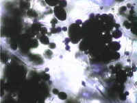 potato_stained_with_IKI_200x_small.jpg