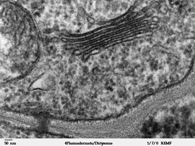 Aparato de Golgi que muestra la estructura unida a la membrana central y las vesículas rodeadas por una sola membrana.