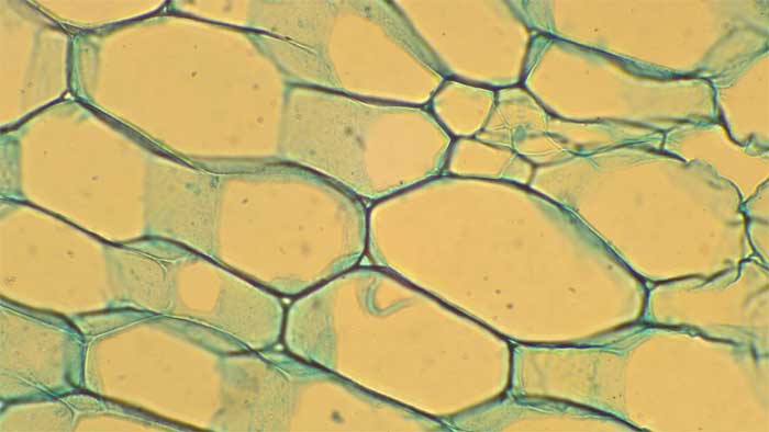 Células de parénquima con paredes celulares delgadas de celulosa azul verdoso.