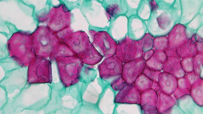 Figura 2.6. Células esclereideas o células de piedra en el fruto de pera. Las células esclereideas tienen paredes celulares gruesas teñidas de rojo y están rodeadas por células de parénquima teñidas de azul verde. (Berkshire Community College Bioscience Image Library, dominio público).