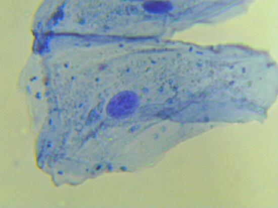thin blue cell with blue nucleus in center