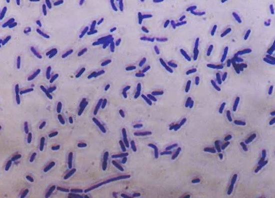 Simple stain bacteria wikicommons.JPG