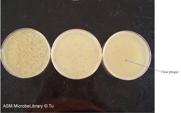 Plaques serial dilution.JPG