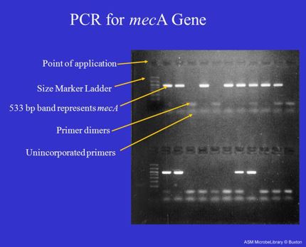 pcr mecA gene.JPG