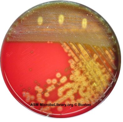Blood agar w sample.JPG