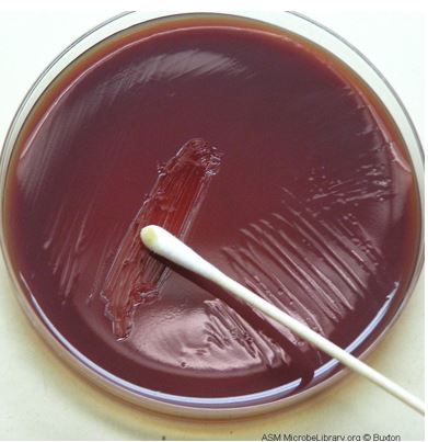 blood agar w proteus.JPG