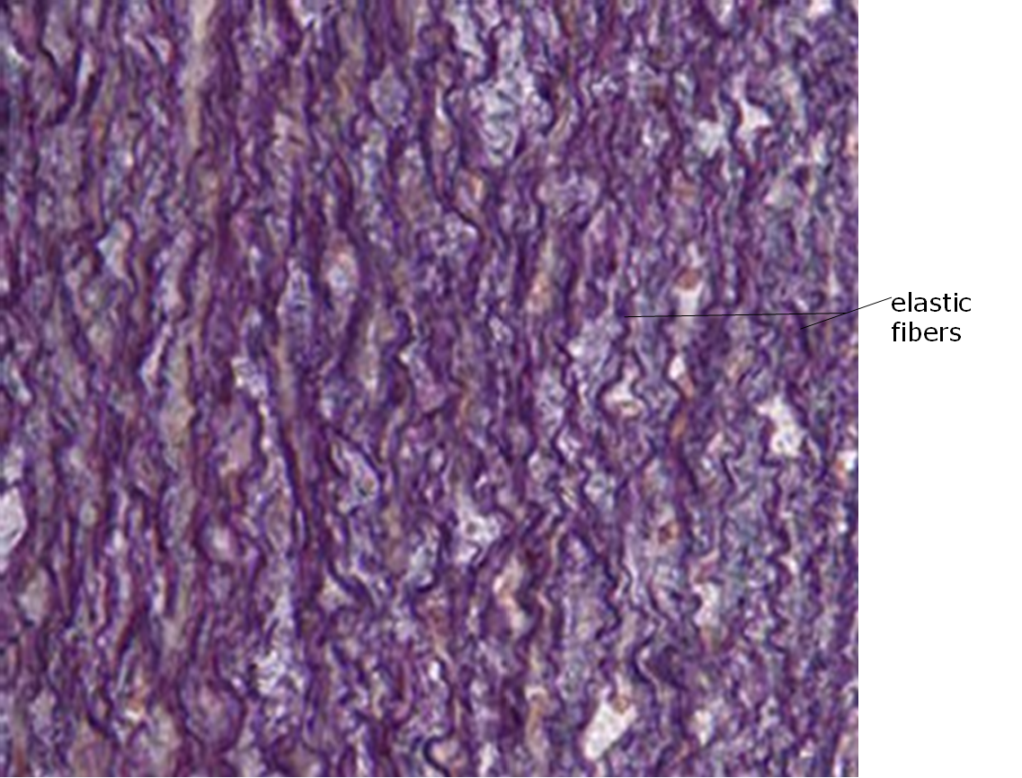 Microscopic image of dense elastic connective tissue.