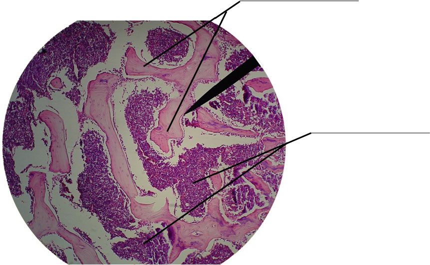 Microscopic image of spongy bone for labeling.