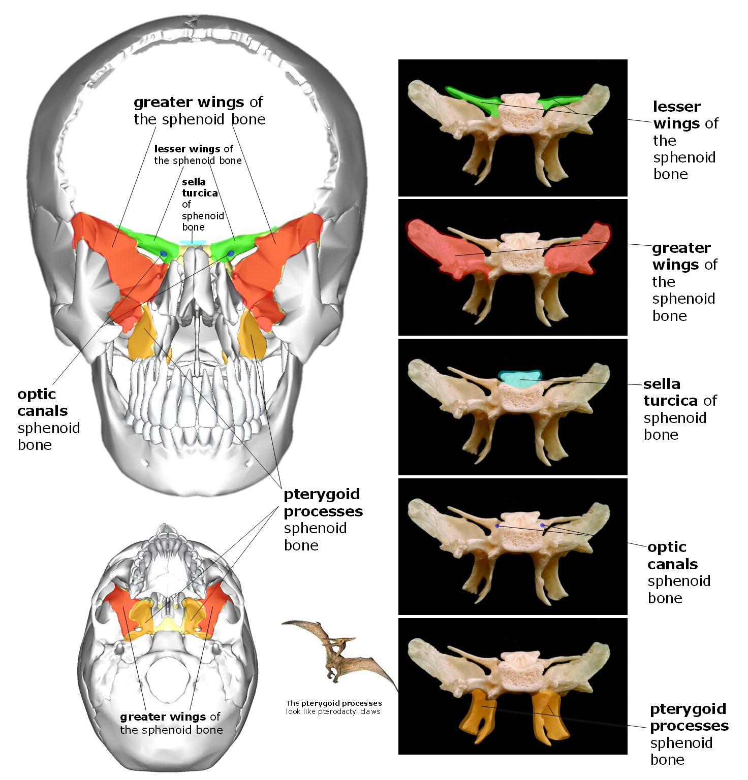 Diagram showing position and structures of the sphenoid bone of the skull.