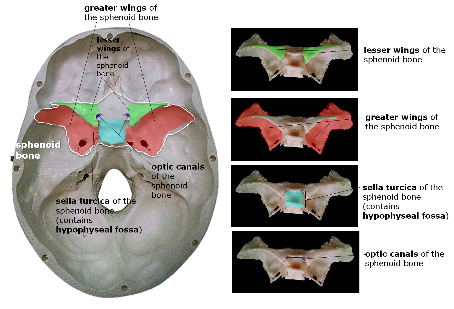 Position of the sphenoid bone from the view of the cranial cavity.