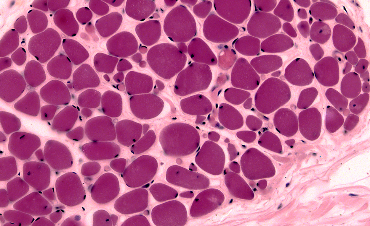 Microscopic image of skeletal muscle fascicle cross section