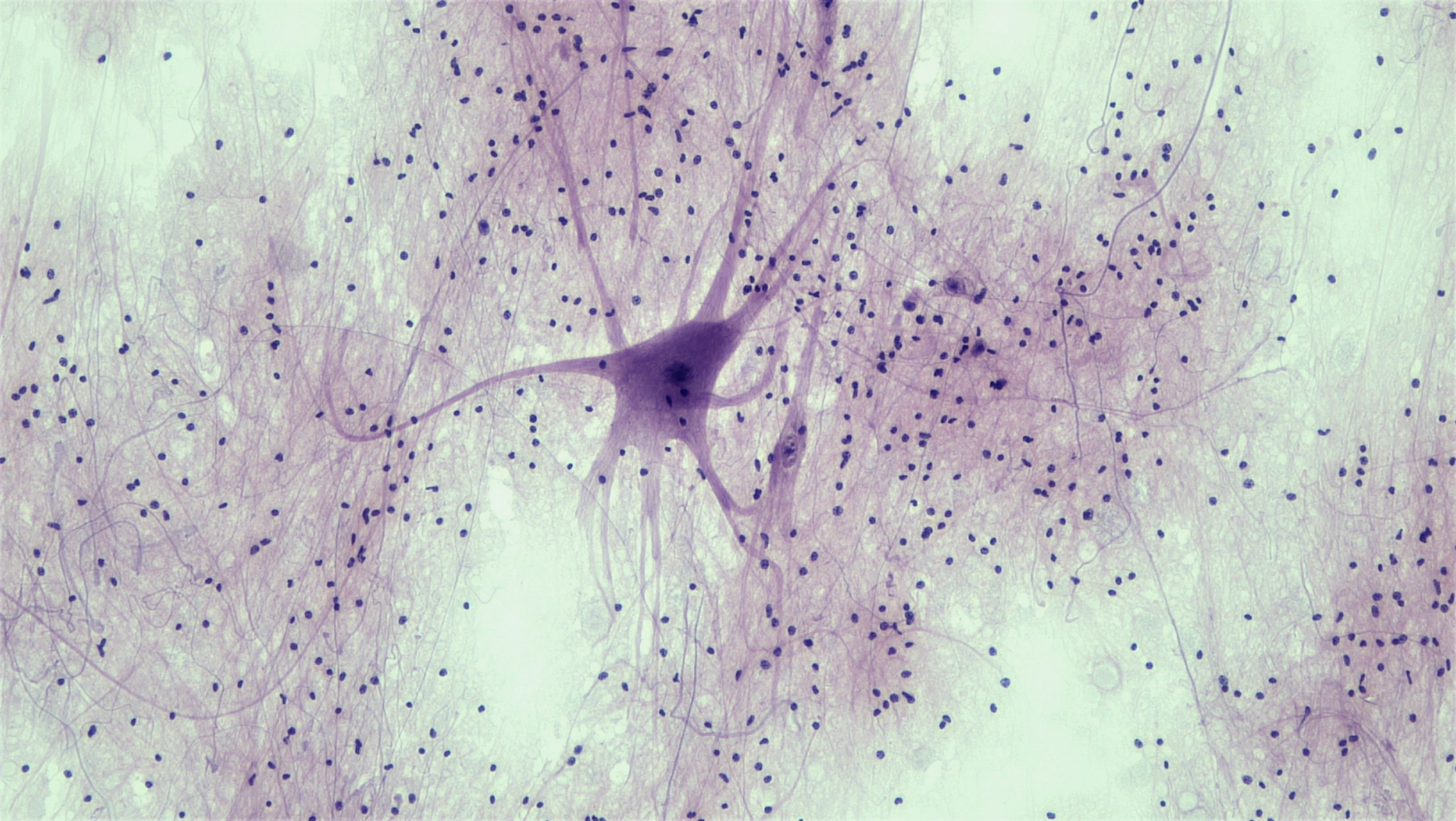 Microscopic image of nervous tissue