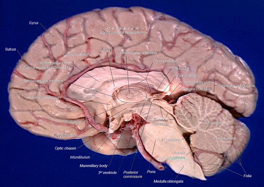 Structures of the brain show with a midsagittal cut to view the deeper structures.