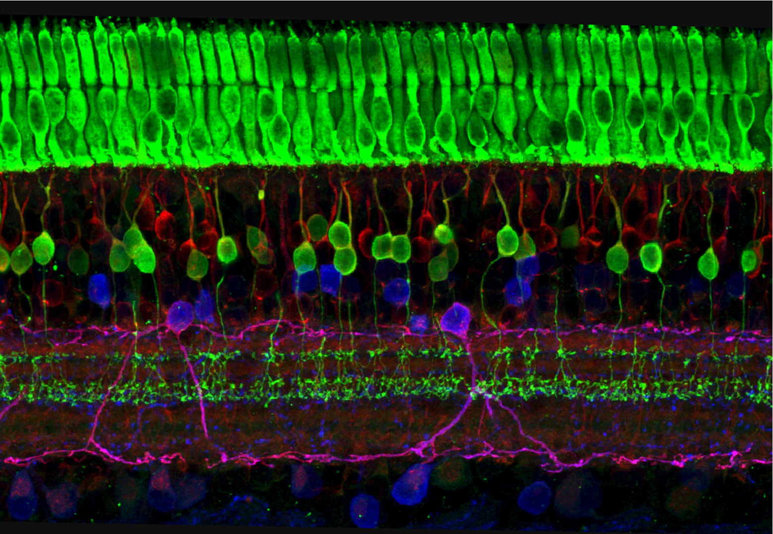 Microscopic image of tissue of the retina